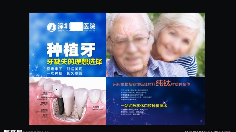 半口种植牙：耐用性与优缺点的全面解析